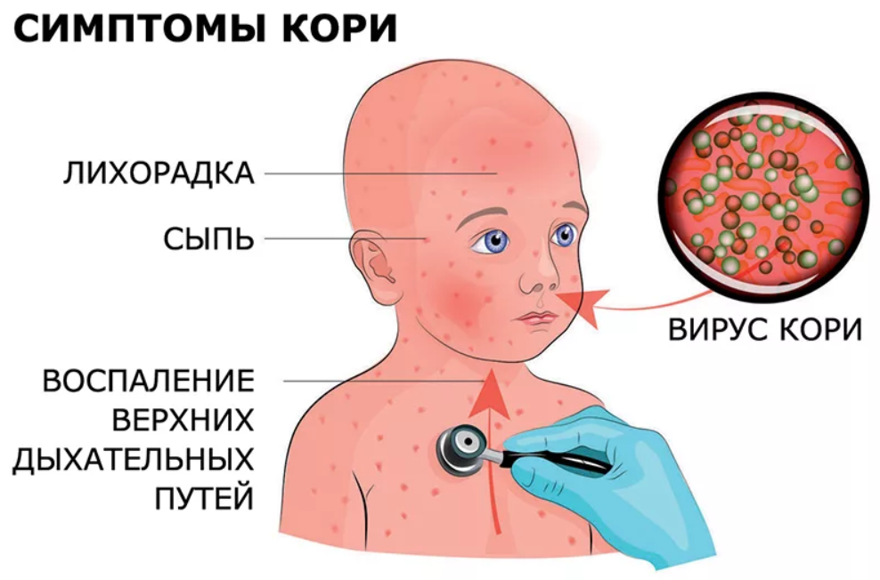 Пятна при кори фото