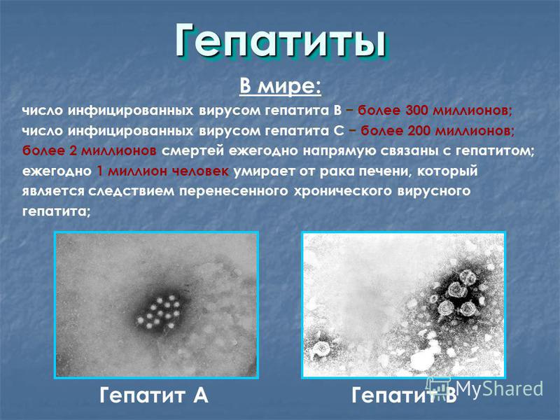 Вероятность гепатит