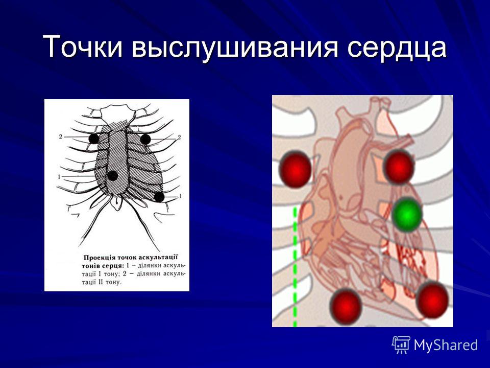 Точки аускультации сердца