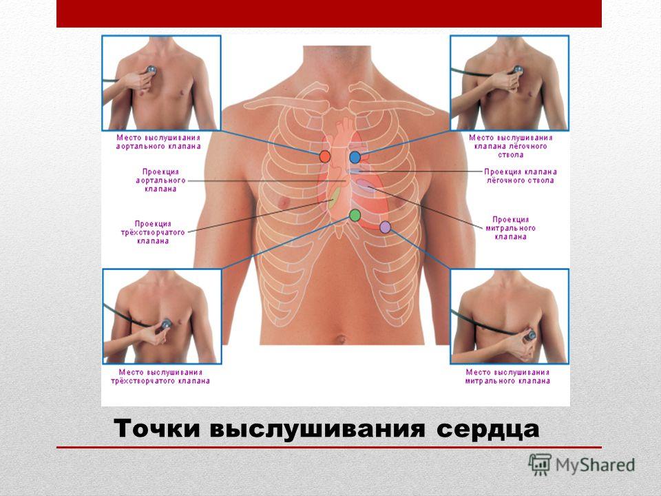 Точки аускультации сердца. Точка выслушивания митрального клапана. Аускультация клапанов сердца. Аускультация сердца митральный клапан. Аускультация митрального клапана.