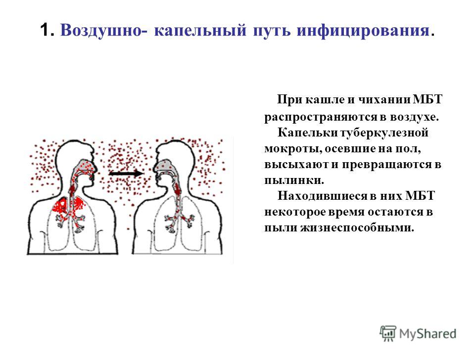 Передается ли воздушно капельным. Воздушно-капельный путь передачи инфекции. Воздушно капельный путь заражения. Воздушно капельный способ передачи инфекции. Заражение воздушно капельным путем это как.