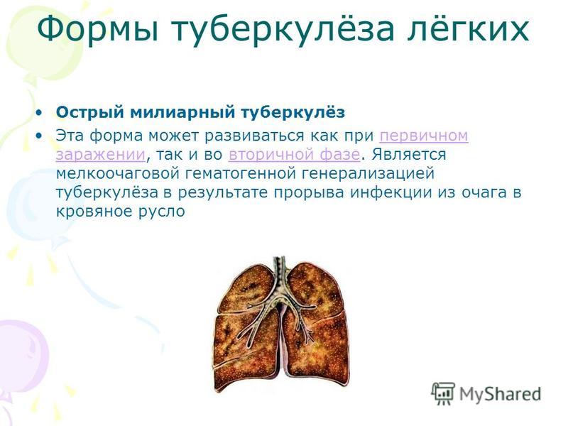 Появление туберкулеза. Формы туберкулёза лёгких. Легочные формы туберкулеза.