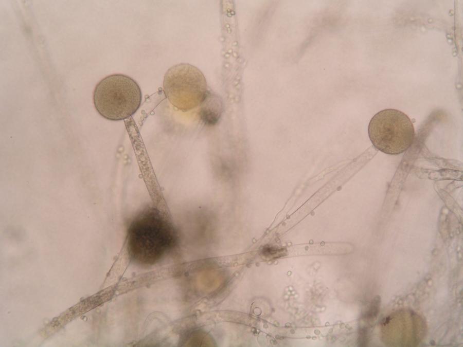 На коже обнаружены споры. Мукор ризопус. Микрофотография гриба ризопус. Плесневые грибы Rhizopus. Mucor mucedo строение.