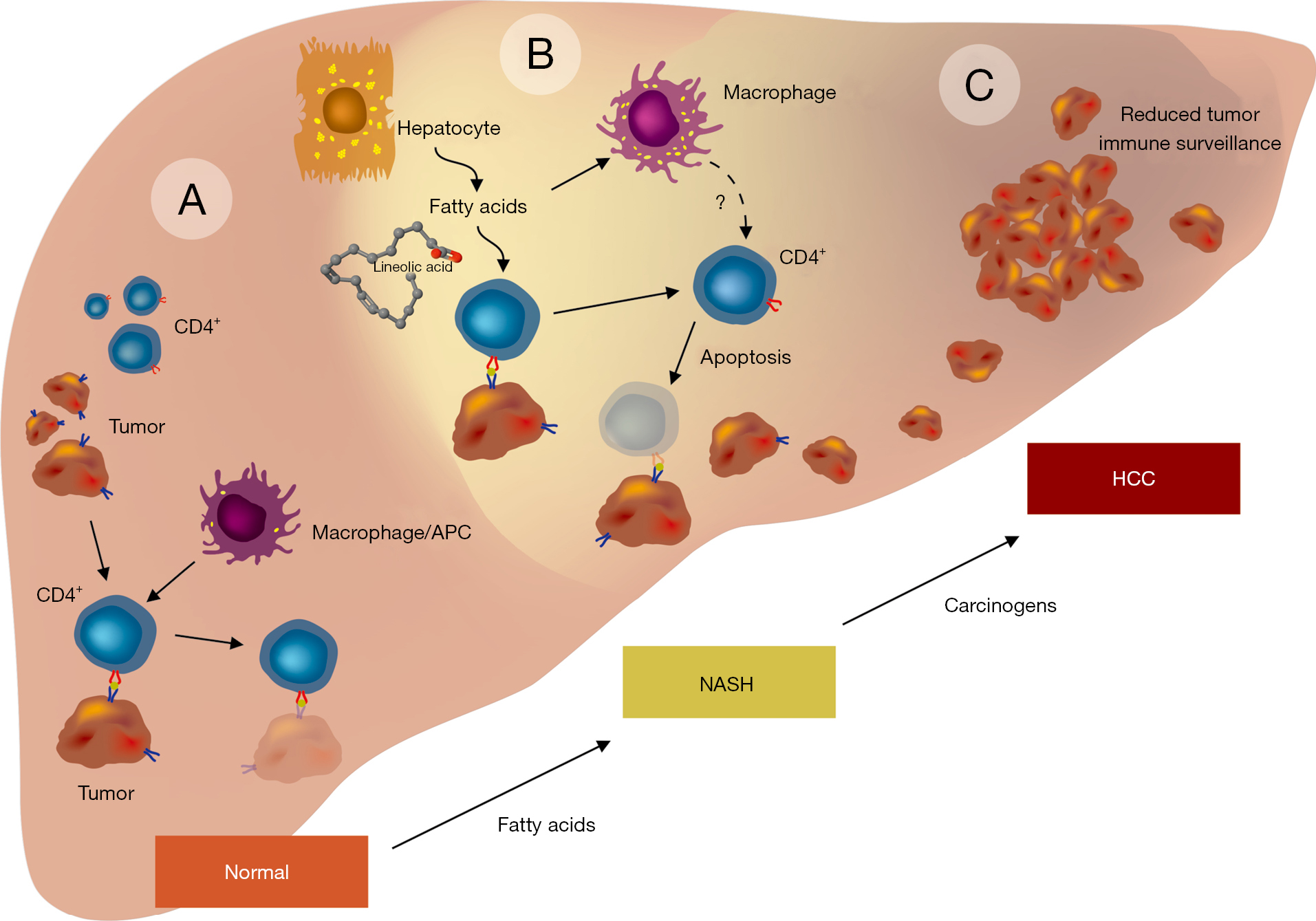 Иммунные клетки печени. Этиология метастаз печени. Метастатические опухоли печени. Функции печени в иммунной системе.
