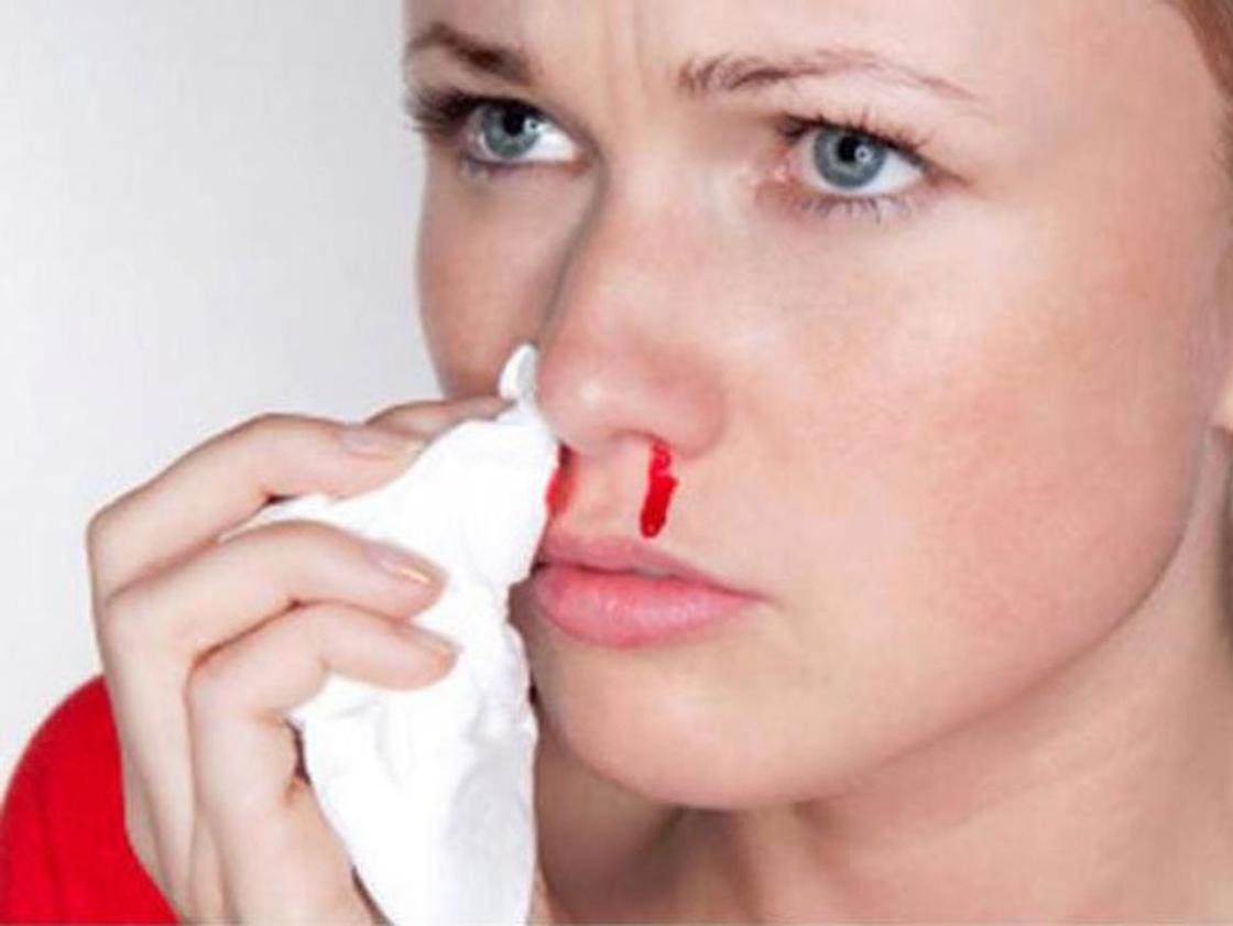 Резкое носовое кровотечение