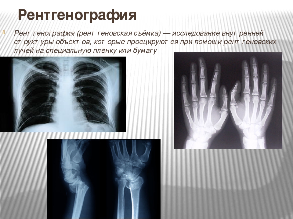 Почему рентген. Рентгенографическое исследование. Рентгенография методы исследования. Методики рентгенографии. Рентгеноскопия и рентгенография.