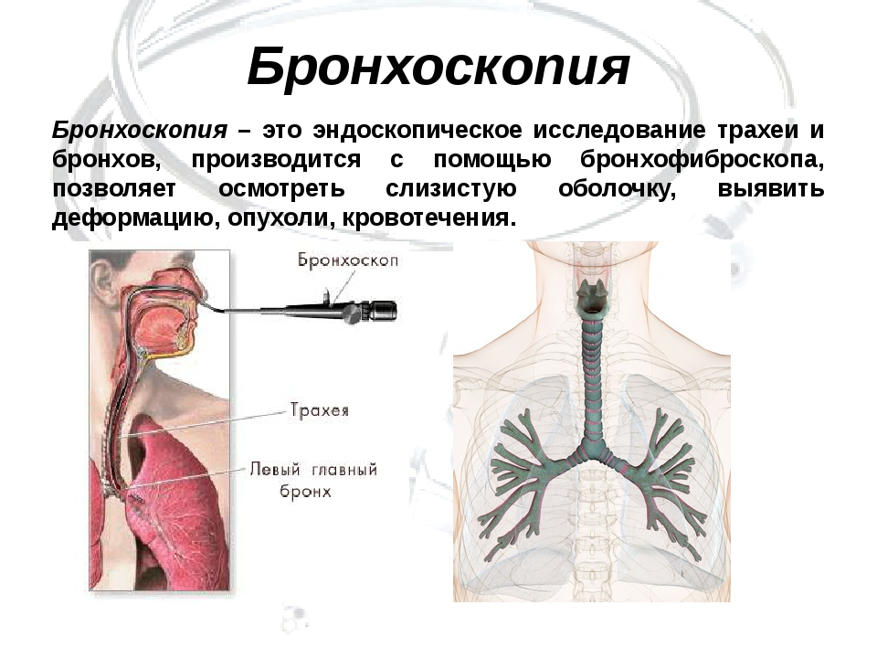 Легкое проведение. Бронхоскопия эндоскопическое исследование бронхов. Эндоскопическое исследование слизистой оболочки трахеи и бронхов. Методы исследования легких бронхоскопия. Методы исследования трахеи и бронхов.