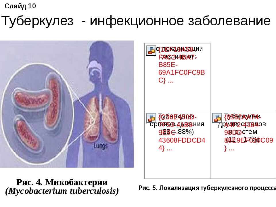 Закрытый туберкулез. Поражение органов туберкулезом. Слайды по туберкулезу. Вид больного туберкулезом.