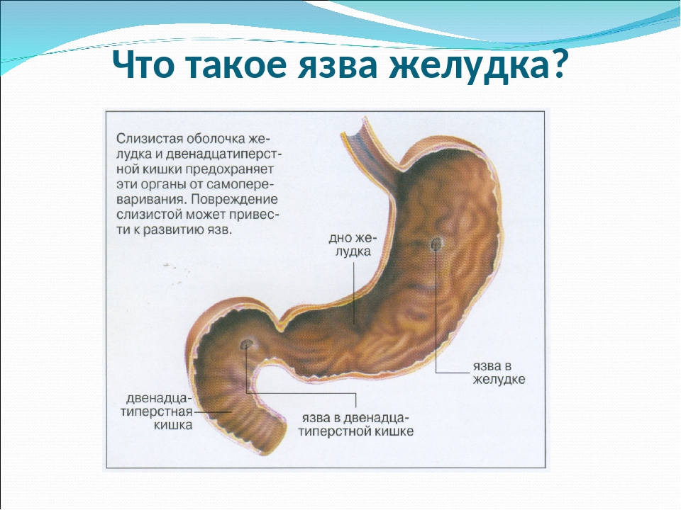 Желудок 8 класс. Язва пищеварительной системы. Языка двенадцатиперстной кишки.