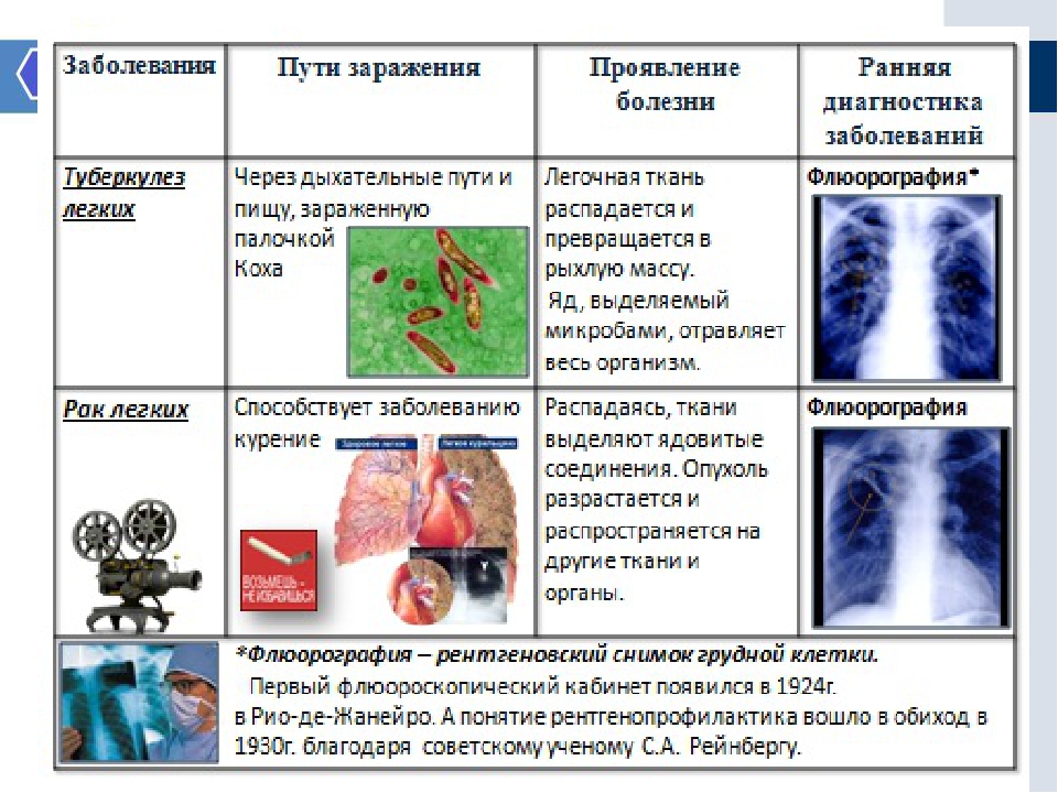 Заболевания биология 8 класс. Болезни дыхательной системы и их профилактика. Заболевание органов дыхания и их гигиена. Заболевания органов дыхания и их предупреждение. Болезни органов дыхания и их профилактика таблица.