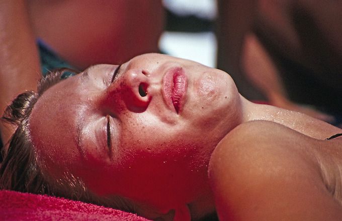 woman sunbathing sunburn