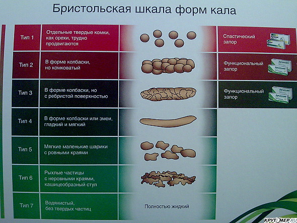 Классификация кала