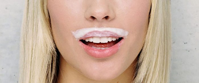 Причины шелушения кожи вокруг рта