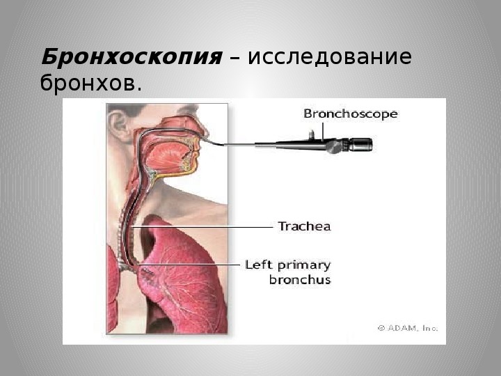 Бронхоскопия легких. Бронхоскопия метод исследования. Бронхоскопия это исследование. Исследование бронхов бронхоскопия.