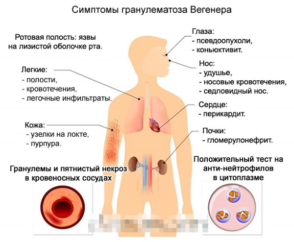 Аллергия на коже в виде красных пятен. Лечение на руках, ногах, шее у взрослых и детей, если чешутся