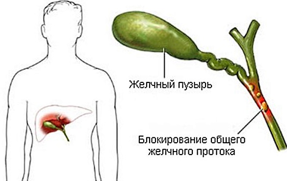 Желчный пузырь. Симптомы заболеваний, диагностика и лечение. Препараты, народные средства, диета