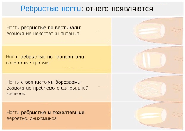 Заболевания ногтей на ногах. Признаки, фото, лечение грибка, инфекции, онихомикоза