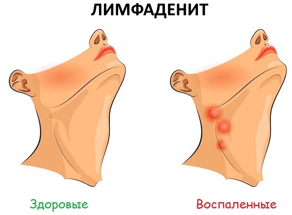 Заболевания ногтей на ногах. Признаки, фото, лечение грибка, инфекции, онихомикоза