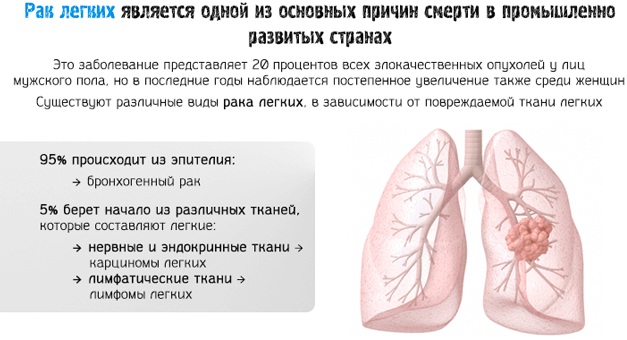 Мокрота с кровью при отхаркивании. Что это может быть, чем лечить