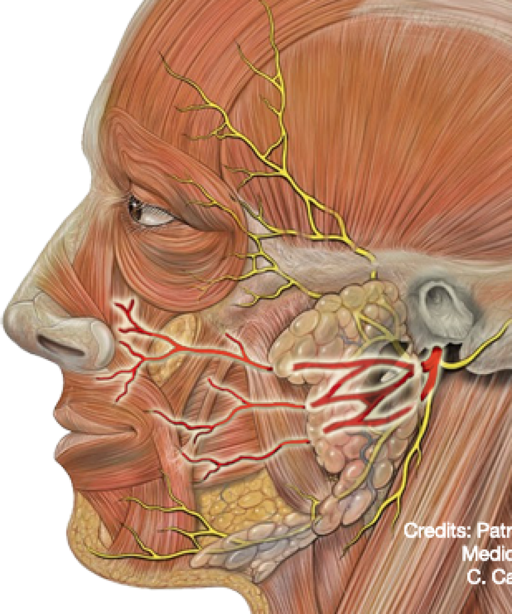 Неврит тройничного нерва. Тройничный лицевой нерв. Невралгия лицевого нерва. Невринома тройничного нерва.