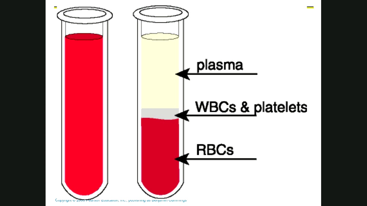 Компоненты сыворотки крови. Плазма крови. Плазма отделяется от крови. Гемолиз крови в пробирке. Состав крови в пробирке.
