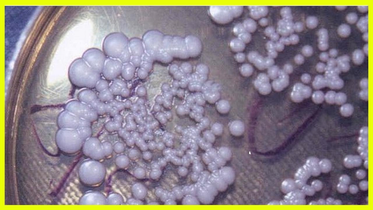 Молочница гриб. Поверхностный кандидоз. Женские выделения под микроскопом. Урогенитальный кандидоз.