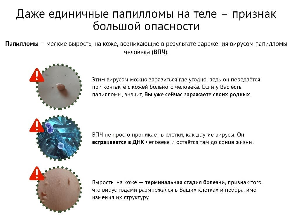 Папиломы вирус передается от человека к человеку. Вирус ВПЧ как выглядит. Вирус папилломы человека на теле.