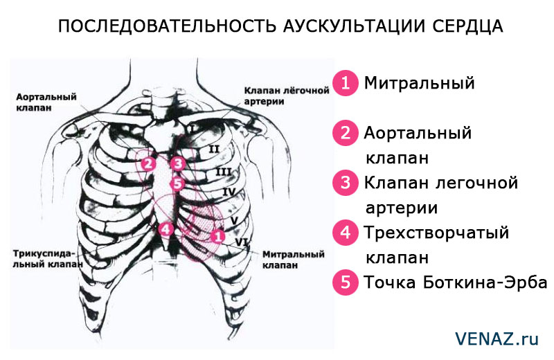 Аускультация сердца. Место выслушивания клапана легочного ствола. Основные точки аускультации. Точка выслушивания митрального клапана. Места аускультации сердца.