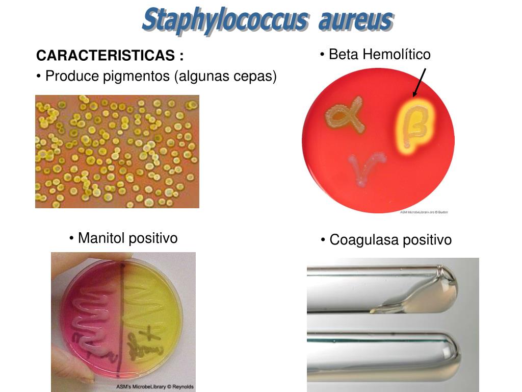 Staphylococcus aureus в носу. Стафилококк aureus в носу. Золотистый стафилококк бета.