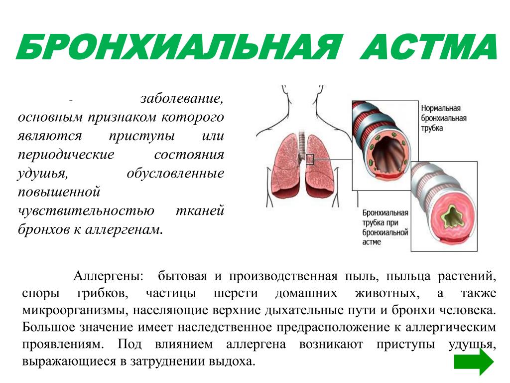 Является основным проявлением заболеваний. Бронхиальная астма. Бронхиальная астма патология. Бронхиальная астма симптомы. Больной бронхиальной астмой.