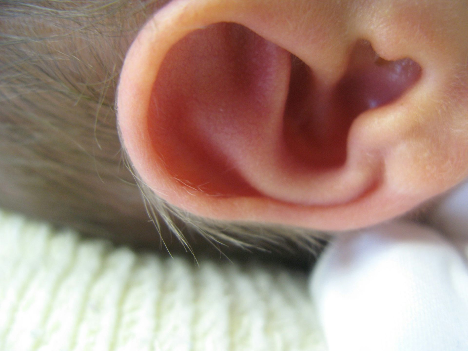 Ушная раковина атавизм. Волосы на ушах у новорожденного.