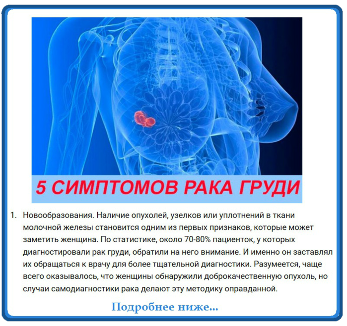 Злокачественная опухоль какая стадия. Онкология молочной железы. Злокачественная опухоль груди.