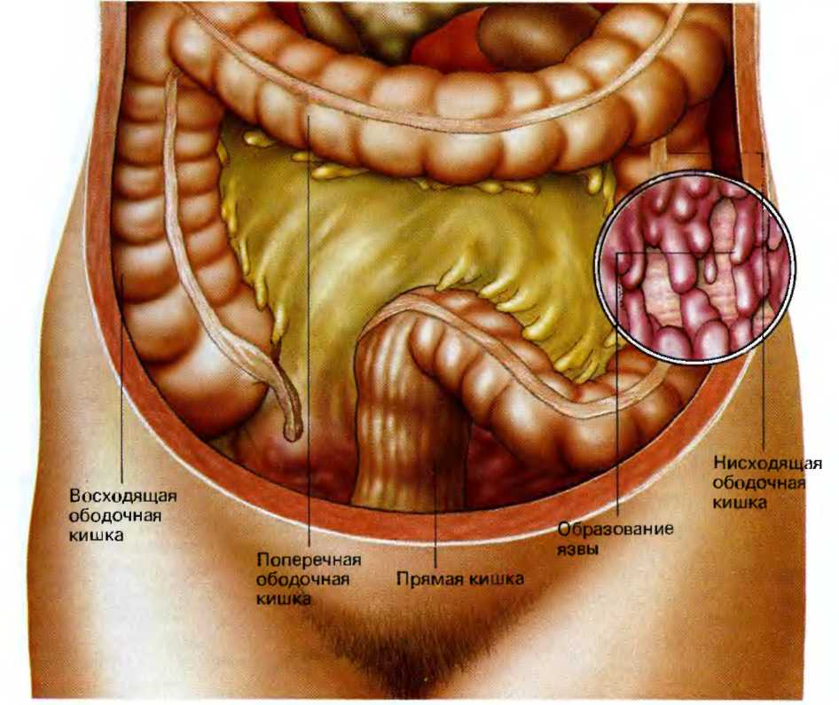 Болят кишки фото. Поперечно ободочный отдел толстой кишки. Поперечно ободочная кишка анатомия. Толстая кишка расположение строение. Восходящая ободочная кишка расположение.
