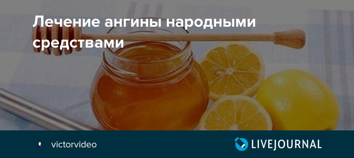 Лечу народными средствами. Ангина народные средства. Народные средства вылечить ангину. Народные методы от ангины. Лечить ангину народными средствами.