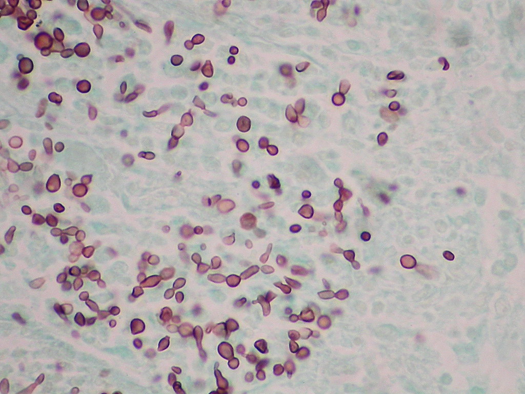 Молочница бактерии. Candida albicans под микроскопом. Грибок кандида под микроскопом. Микроскопические грибы кандида. Кандида альбиканс мазок.