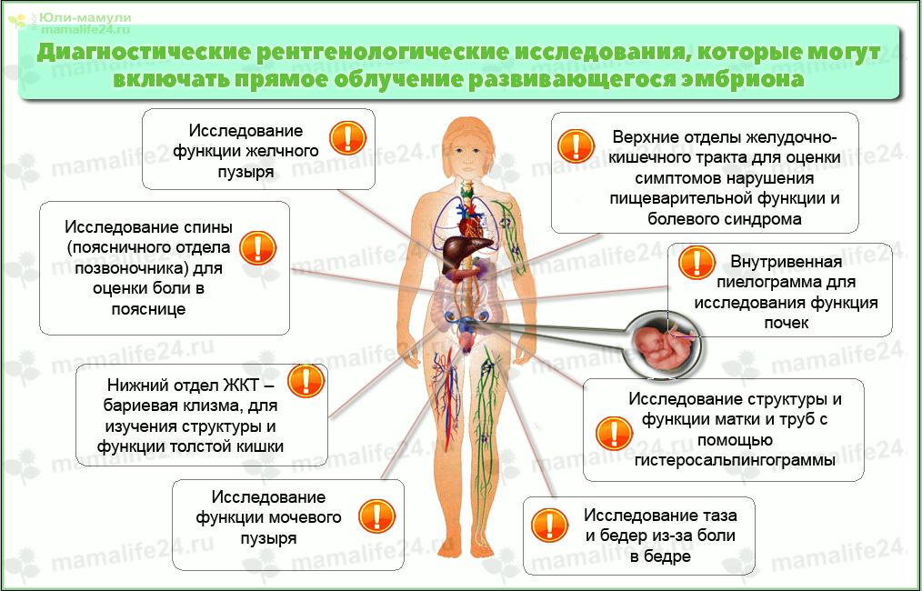 Можно ли при беременности делать. Можно ли беременным делать флюорографию. Флюорография беременной. Флюорография беременность. Флюорография на ранних сроках.