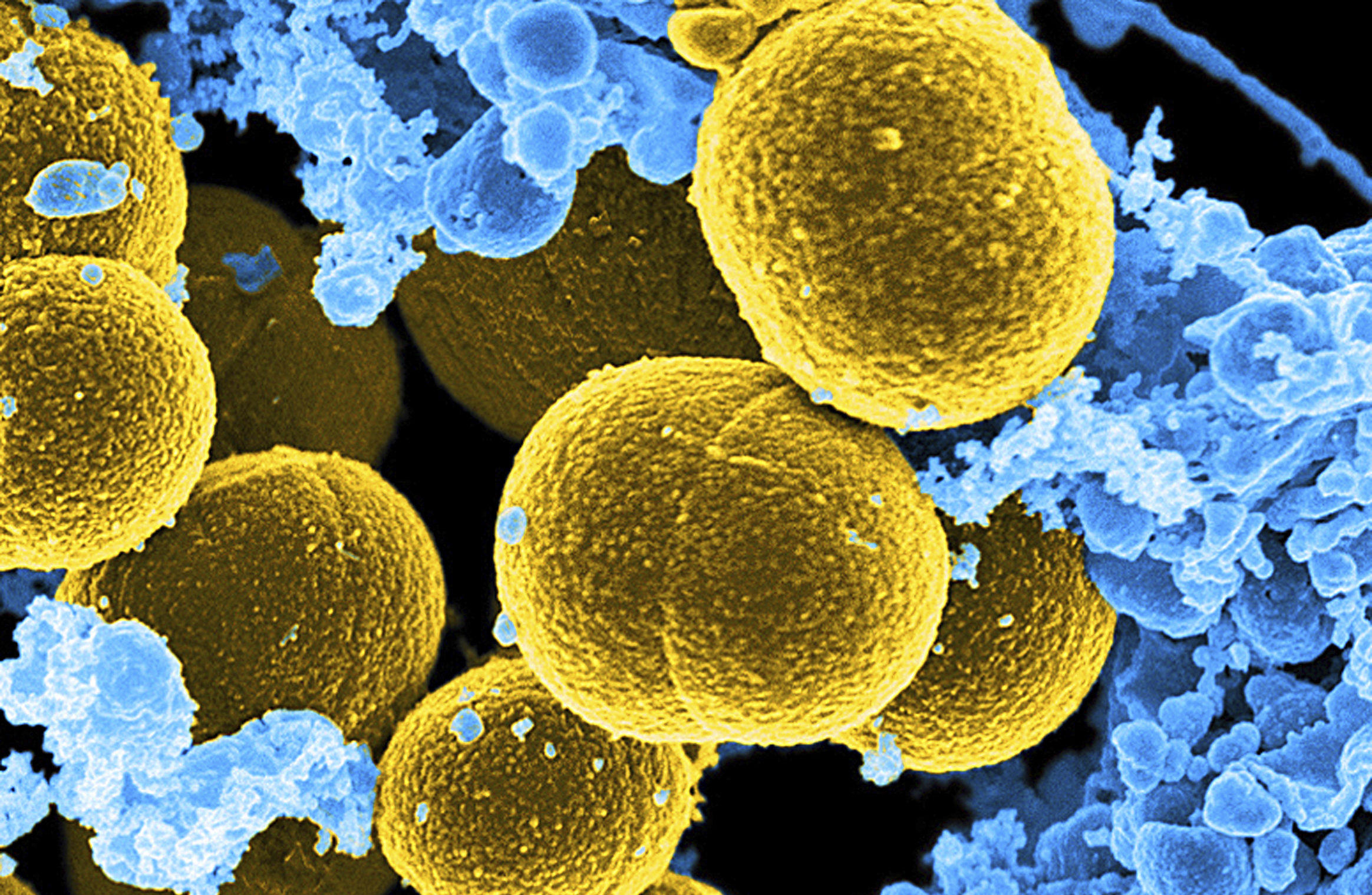 Staphylococcus aureus золотистый стафилококк. Бактерия золотистый стафилококк. S. aureus золотистый стафилококк. Стафилококк золотистый Staphylococcus aureus. Стафилококк ауреус заболевания.