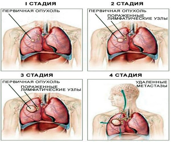 Стадии