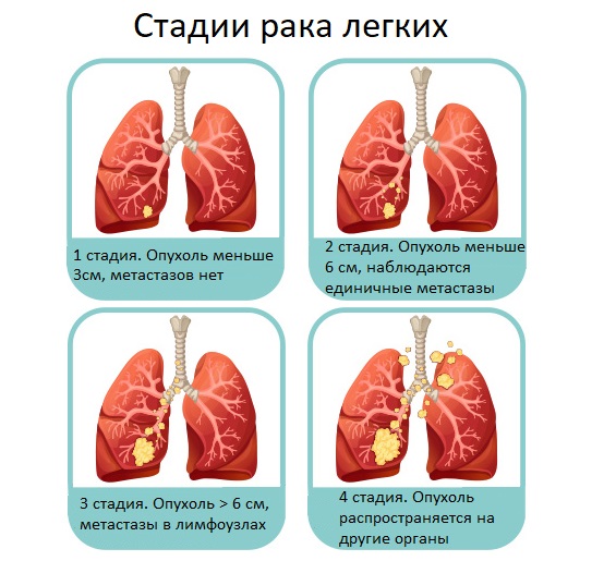 Стадии