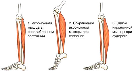 Судорга