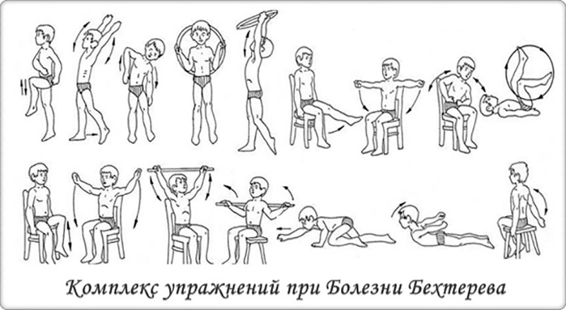 Комплекс больного. Комплекс упражнений при болезни Бехтерева. Болезнь Бехтерева ЛФК комплекс упражнений. ЛФК при болезни Бехтерева комплекс. Лечебная гимнастика при болезни Бехтерева.