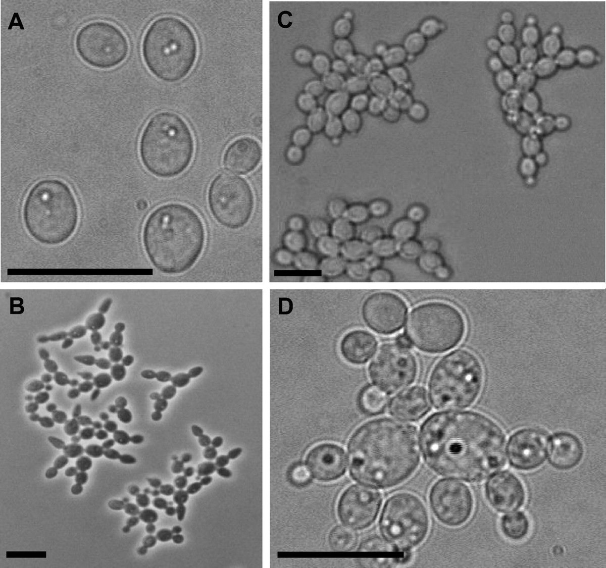 Грибы в кале. Дрожжи Candida под микроскопом. Дрожжевые грибы микроскопия. Дрожжевые клетки в моче микроскопия. Грибки дрожжевые в микроскопии мочи.