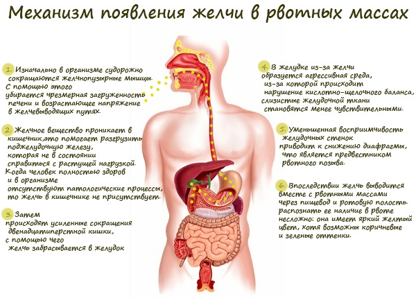 Механизм появления желчи в рвотных массах