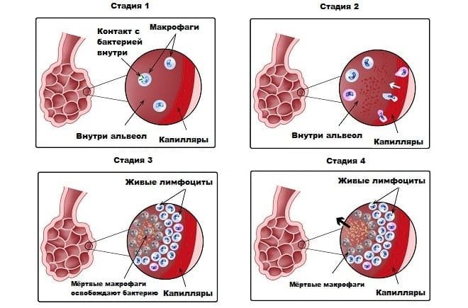 Стадии развития