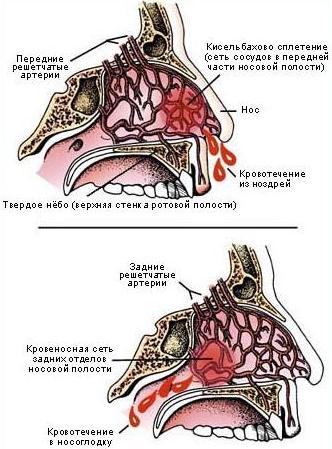 Особенности кровопотери