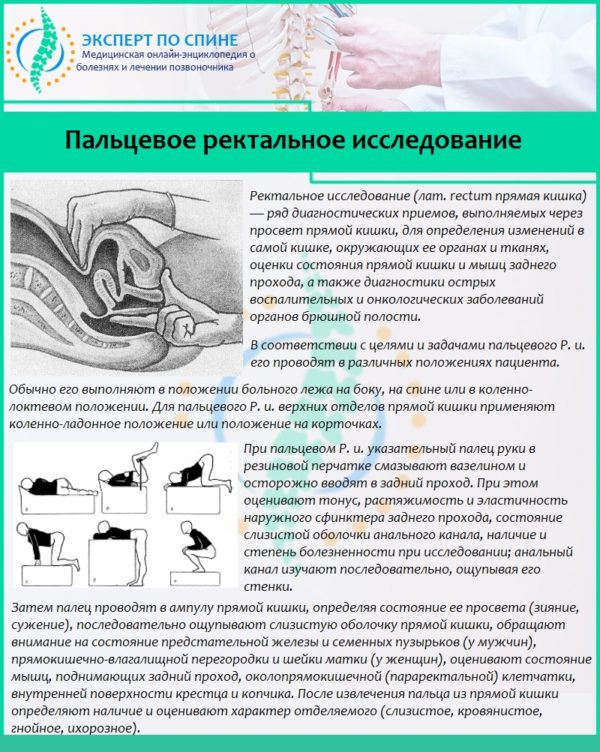 Пальцевое ректальное исследование