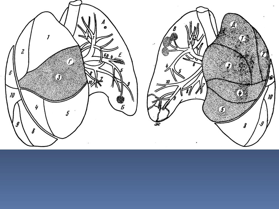 Легкие структурные. Ацинус дольки сегменты. Сегмент легкого ацинус. Долька легкого ацинус. Строение легочной дольки.
