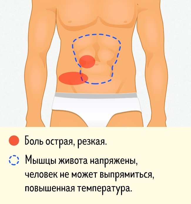 Ноет правый бок у мужчин причины. Локализация боли в животе. Болит вся область живота. Рези возле пупка. Болит справа посередине живота.