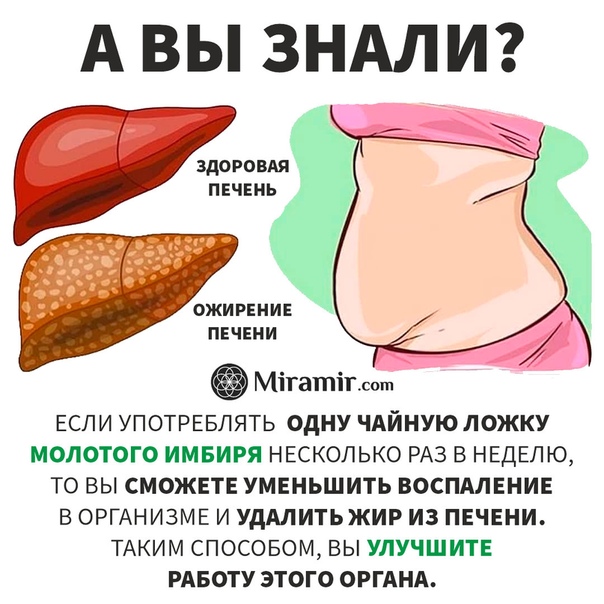 Лечение жирового гепатоза поджелудочной. Ожирение печени гепатоз печени. Жировой гепатоз 1 степени. Жировой гепатоз печени симптомы. Жировой гепатоз 2 степени.
