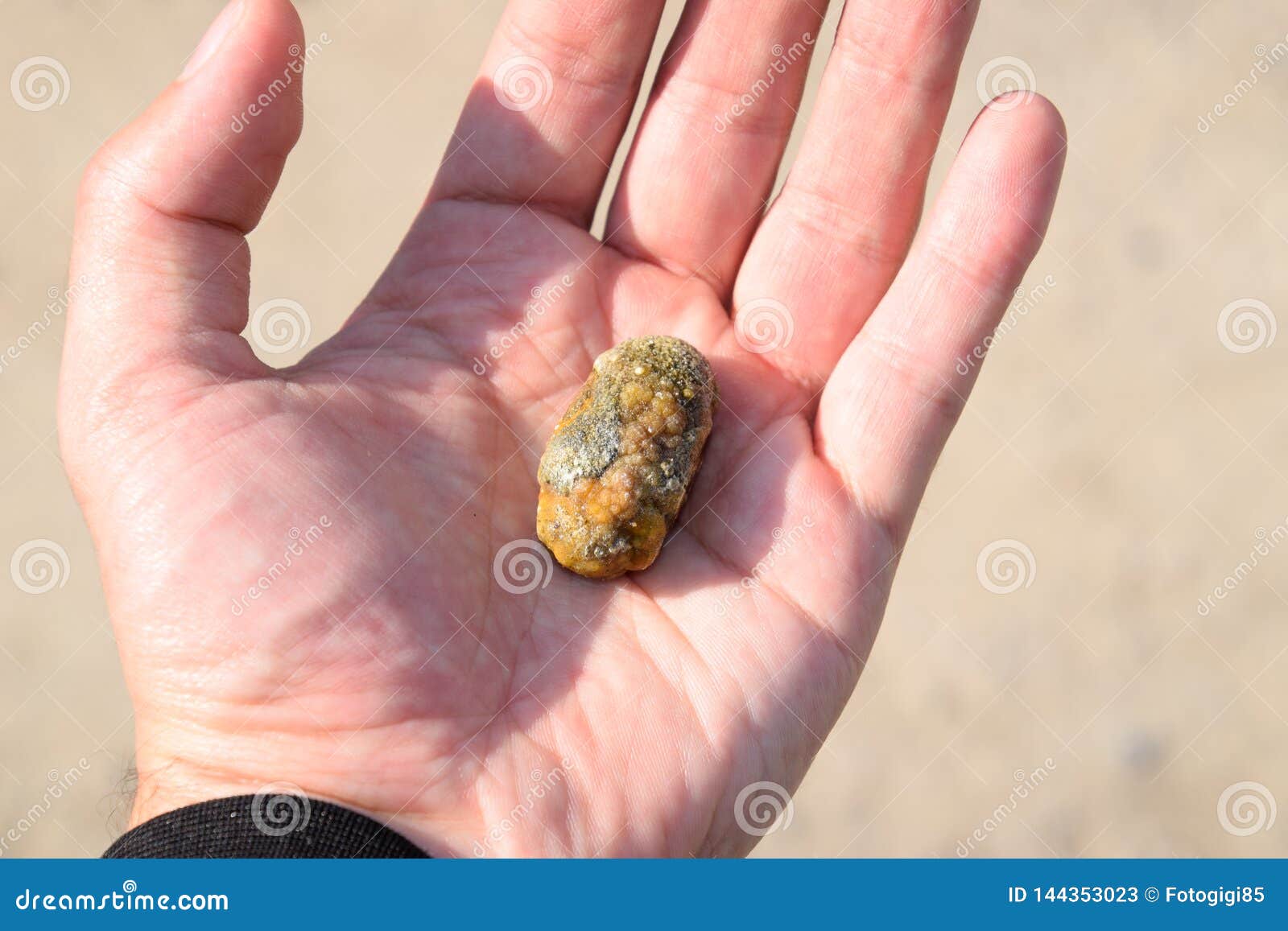 Какого размера камень может выйти сам. Камень в руке. Камни из желчного пузыря.